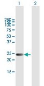 Anti-LYPLA2 antibody produced in mouse purified immunoglobulin, buffered aqueous solution