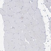 Anti-ATP11C antibody produced in rabbit Prestige Antibodies&#174; Powered by Atlas Antibodies, affinity isolated antibody, buffered aqueous glycerol solution