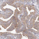 Anti-WDR77 antibody produced in rabbit Prestige Antibodies&#174; Powered by Atlas Antibodies, affinity isolated antibody, buffered aqueous glycerol solution, ab2