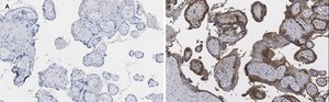 Anti-BCRP (ABCG2) Antibody, clone 10K5 , ZooMAb&#174; Rabbit Monoclonal recombinant, expressed in HEK 293 cells