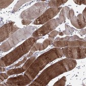 Anti-PPP1R3A antibody produced in rabbit Prestige Antibodies&#174; Powered by Atlas Antibodies, affinity isolated antibody, buffered aqueous glycerol solution