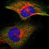 Anti-IKBKB antibody produced in rabbit Prestige Antibodies&#174; Powered by Atlas Antibodies, affinity isolated antibody, buffered aqueous glycerol solution