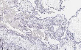 Anti-FAK Antibody, clone 1D14 ZooMAb&#174; Rabbit Monoclonal recombinant, expressed in HEK 293 cells