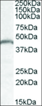 Anti-PNPLA3 antibody produced in goat affinity isolated antibody, buffered aqueous solution