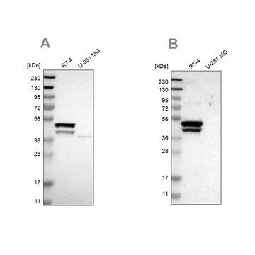 Anti-KRT23 antibody produced in rabbit Prestige Antibodies&#174; Powered by Atlas Antibodies, affinity isolated antibody, buffered aqueous glycerol solution