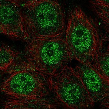 Anti-WDYHV1 antibody produced in rabbit Prestige Antibodies&#174; Powered by Atlas Antibodies, affinity isolated antibody