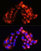 Anti- SQSTM1/p62 antibody produced in rabbit
