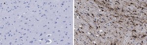 Anti-GFAP Antibody, clone 2E8, ZooMAb&#174; Rabbit Monoclonal recombinant, expressed in HEK 293 cells
