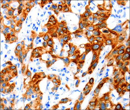 Anti-SLC2A11 antibody produced in rabbit affinity isolated antibody