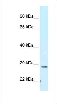 Anti-TMEM106B antibody produced in rabbit affinity isolated antibody