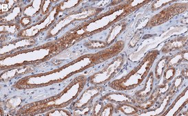 Anti-Rab8A Antibody, clone 1N22 ZooMAb&#174; Rabbit Monoclonal recombinant, expressed in HEK 293 cells