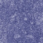 Anti-PDYN antibody produced in rabbit Prestige Antibodies&#174; Powered by Atlas Antibodies, affinity isolated antibody, buffered aqueous glycerol solution