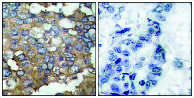 Anti-SRC (Ab-529) antibody produced in rabbit affinity isolated antibody