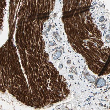 Anti-ACVR1 antibody produced in rabbit Prestige Antibodies&#174; Powered by Atlas Antibodies, affinity isolated antibody, buffered aqueous glycerol solution