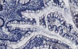 Anti-MGMT Antibody, clone MT3.1 ZooMAb&#174; Mouse Monoclonal recombinant, expressed in HEK 293 cells