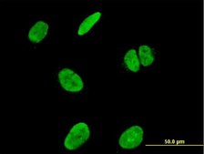 Monoclonal Anti-RUNX2 antibody produced in mouse clone 4D5, purified immunoglobulin, buffered aqueous solution