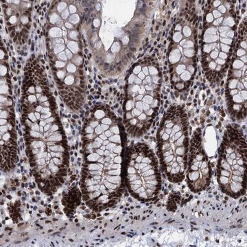 Anti-GALNT11 antibody produced in rabbit Prestige Antibodies&#174; Powered by Atlas Antibodies, affinity isolated antibody, buffered aqueous glycerol solution