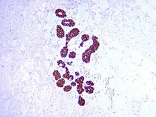 Anti-Cytokeratin 19 Antibody, clone RCK108 clone RCK108, Chemicon&#174;, from mouse