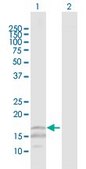 Anti-CD247 antibody produced in rabbit purified immunoglobulin, buffered aqueous solution