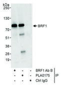 Rabbit anti-BRF1 Antibody, Affinity Purified Powered by Bethyl Laboratories, Inc.