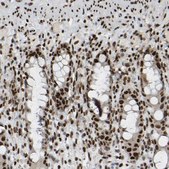 Anti-NUMA1 antibody produced in rabbit Prestige Antibodies&#174; Powered by Atlas Antibodies, affinity isolated antibody, buffered aqueous glycerol solution, Ab2