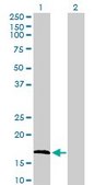 Anti-FGF1 antibody produced in rabbit purified immunoglobulin, buffered aqueous solution