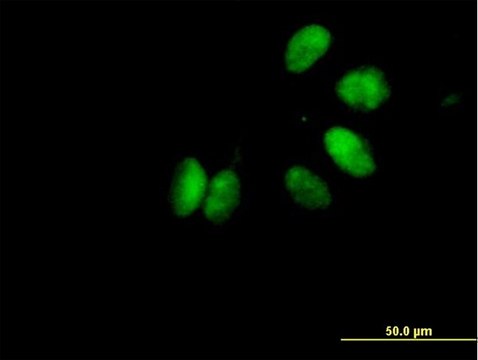 Anti-CHEK2 antibody produced in mouse purified immunoglobulin, buffered aqueous solution