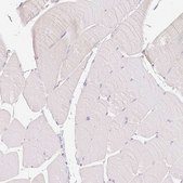 Anti-NVL antibody produced in rabbit Prestige Antibodies&#174; Powered by Atlas Antibodies, affinity isolated antibody, buffered aqueous glycerol solution