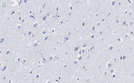 Anti-CaM Kinase II&#945; Antibody, clone 1C20 ZooMAb&#174; Rabbit Monoclonal recombinant, expressed in HEK 293 cells
