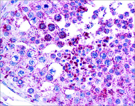 Anti-MAGEA3 antibody produced in rabbit affinity isolated antibody