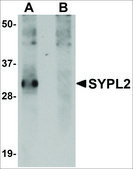 Anti-SYPL2 antibody produced in rabbit affinity isolated antibody, buffered aqueous solution