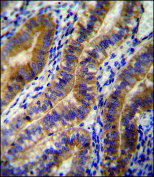 ANTI-ANGPT2 (C-TERM) antibody produced in rabbit IgG fraction of antiserum, buffered aqueous solution