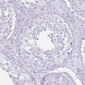 Anti-SLC4A4 antibody produced in rabbit Prestige Antibodies&#174; Powered by Atlas Antibodies, affinity isolated antibody, buffered aqueous glycerol solution