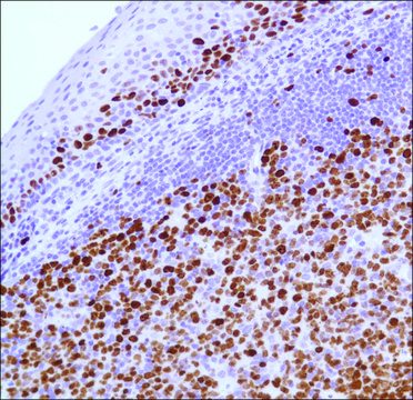 Anti-KI-67 antibody, Rabbit monoclonal recombinant, expressed in proprietary host, clone SP6, tissue culture supernatant