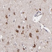 Anti-NF2 antibody produced in rabbit Prestige Antibodies&#174; Powered by Atlas Antibodies, affinity isolated antibody, buffered aqueous glycerol solution