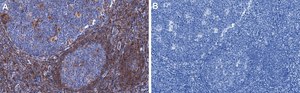 Anti-ASC/PYCARD Antibody, clone 1C19 ZooMAb&#174; Rabbit Monoclonal recombinant, expressed in HEK 293 cells