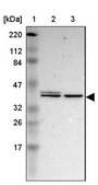 Anti-MAPK3 antibody produced in rabbit Ab2, Prestige Antibodies&#174; Powered by Atlas Antibodies, affinity isolated antibody, buffered aqueous glycerol solution