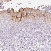 Anti-UPK2 antibody produced in rabbit Prestige Antibodies&#174; Powered by Atlas Antibodies, affinity isolated antibody, buffered aqueous glycerol solution