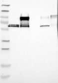 Anti-NEXN antibody produced in rabbit Prestige Antibodies&#174; Powered by Atlas Antibodies, affinity isolated antibody, buffered aqueous glycerol solution