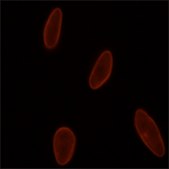 Monoclonal Anti-Lamin A/C antibody produced in mouse clone 4C11, purified from hybridoma cell culture