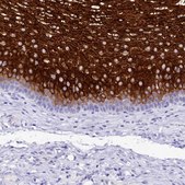 Anti-A2ML1 antibody produced in rabbit Prestige Antibodies&#174; Powered by Atlas Antibodies, affinity isolated antibody, buffered aqueous glycerol solution