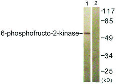 Anti-Fructose 6 Phosphate Kinase antibody produced in rabbit affinity isolated antibody