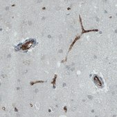 Monoclonal Anti-VWF antibody produced in mouse Prestige Antibodies&#174; Powered by Atlas Antibodies, clone CL1957, purified immunoglobulin, buffered aqueous glycerol solution