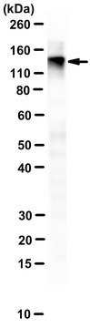 Anti-RFC1 Antibody