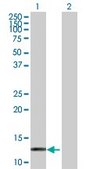 Anti-HBZ antibody produced in rabbit purified immunoglobulin, buffered aqueous solution