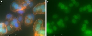 Anti-RAR&#947;1 Antibody, clone 1C22 ZooMAb&#174; Rabbit Monoclonal recombinant, expressed in HEK 293 cells
