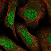 Anti-PPM1F antibody produced in rabbit Prestige Antibodies&#174; Powered by Atlas Antibodies, affinity isolated antibody, buffered aqueous glycerol solution