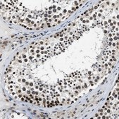 Anti-ZC3HC1 antibody produced in rabbit Prestige Antibodies&#174; Powered by Atlas Antibodies, affinity isolated antibody, buffered aqueous glycerol solution