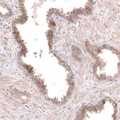 Anti-ACSL3 antibody produced in rabbit Prestige Antibodies&#174; Powered by Atlas Antibodies, affinity isolated antibody, buffered aqueous glycerol solution