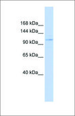 Anti-ST18 affinity isolated antibody